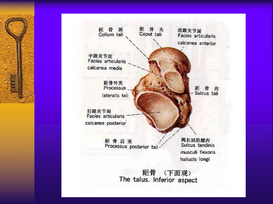 距骨骨折.ppt_第3页