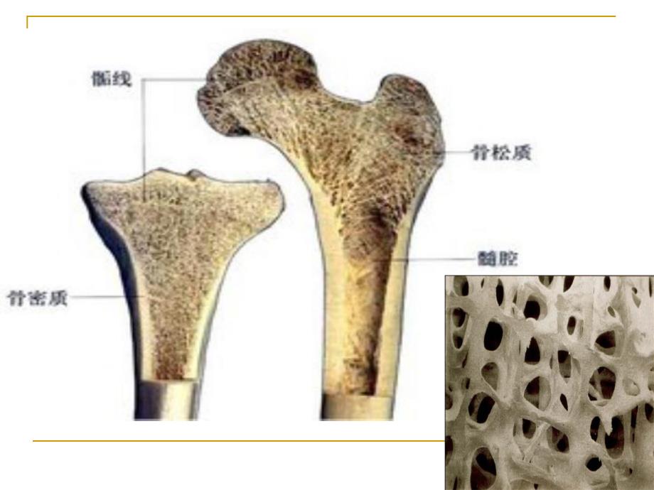 骨质疏松PPT演示文稿.ppt_第2页