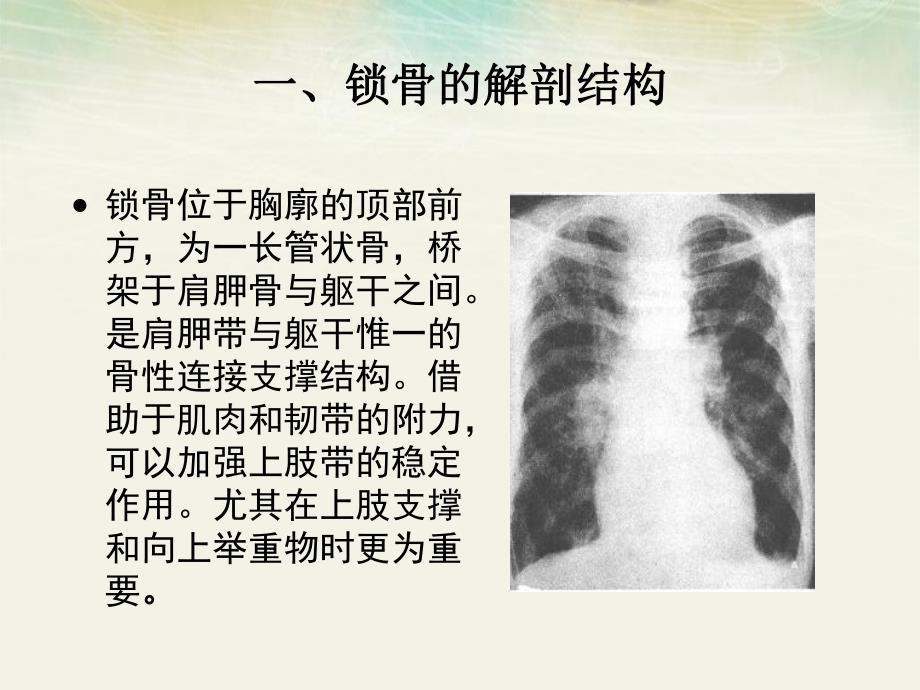 锁骨骨折病人的护理.ppt_第1页