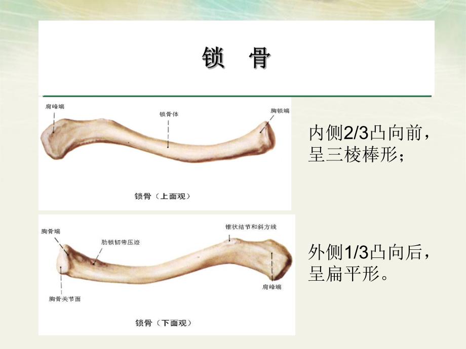 锁骨骨折病人的护理.ppt_第3页