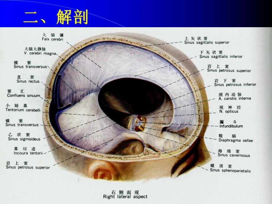 脑静脉窦血栓.ppt_第3页