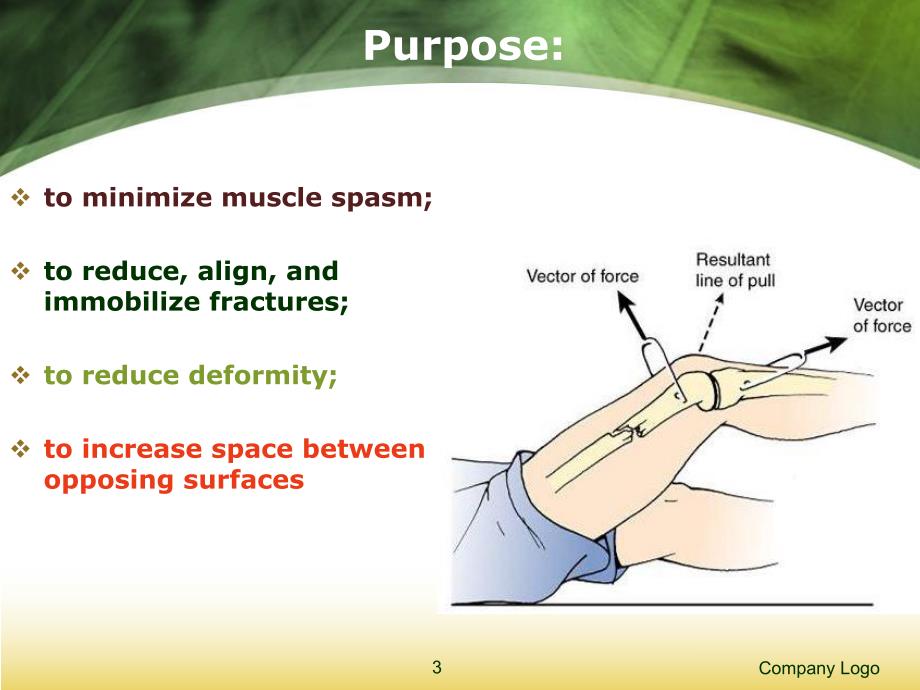 骨科牵引.ppt_第3页