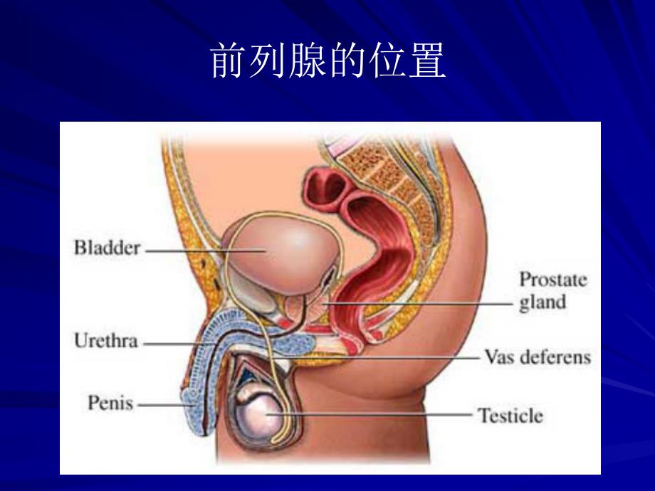 前列腺癌诊断治疗与护理.ppt.ppt_第3页