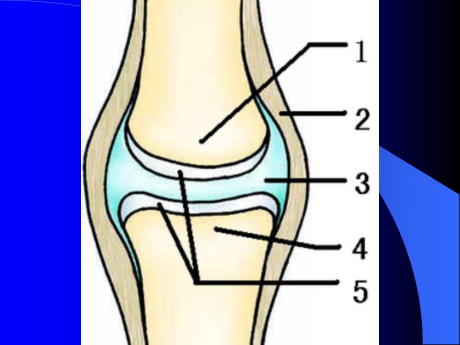 骨性关节炎.ppt_第3页