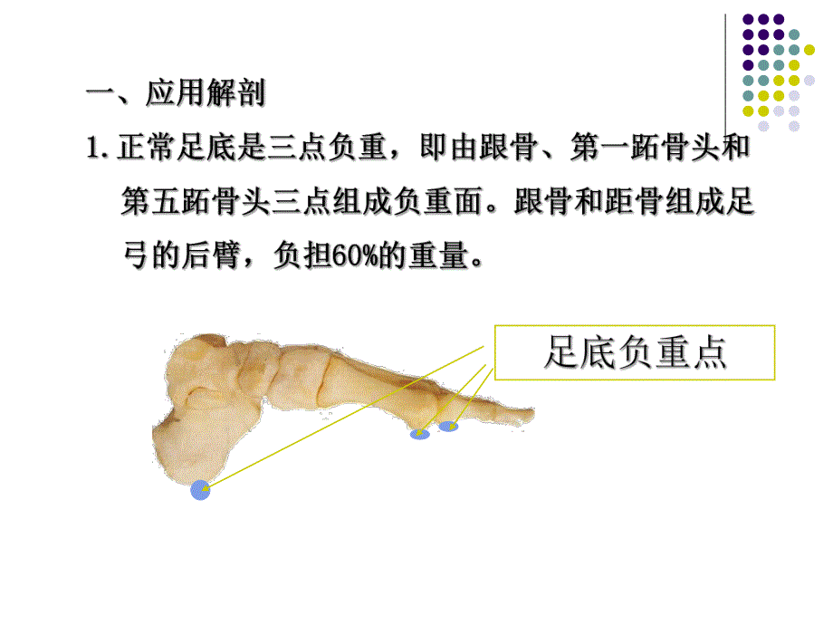 跟骨骨折.ppt_第3页