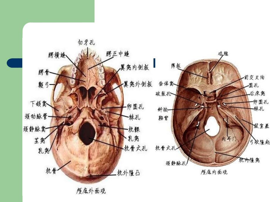 颅底骨折.ppt_第2页