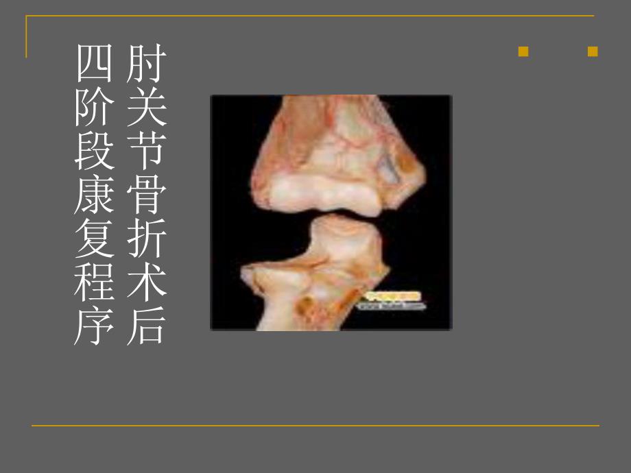 肘关节骨折术后四阶段康复程序.ppt_第1页