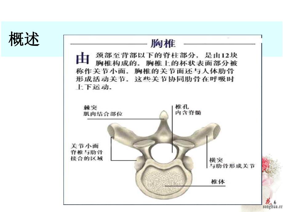 胸椎骨折的护理查房.ppt_第3页