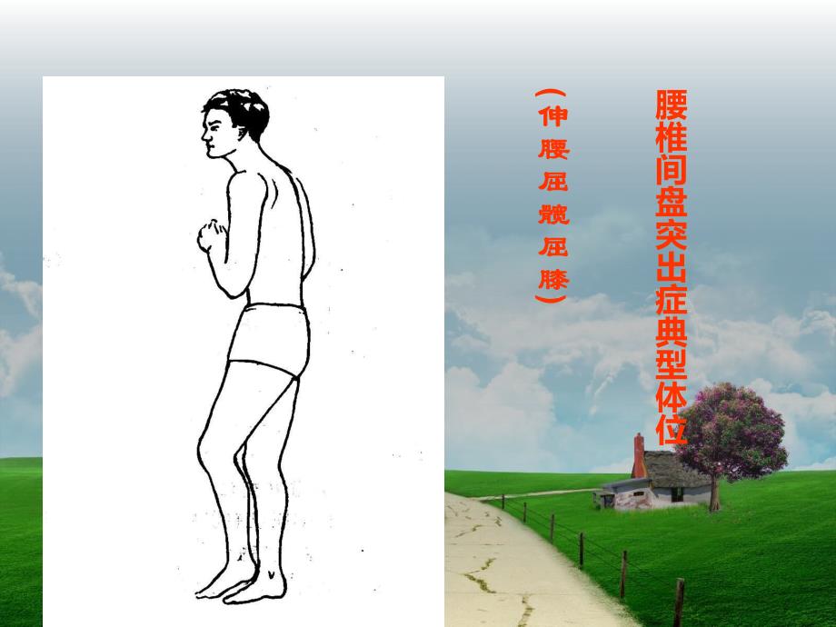 腰椎查体精要.ppt_第3页