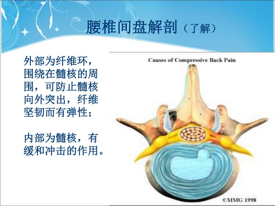 腰椎间盘突出症术后护理.ppt_第3页