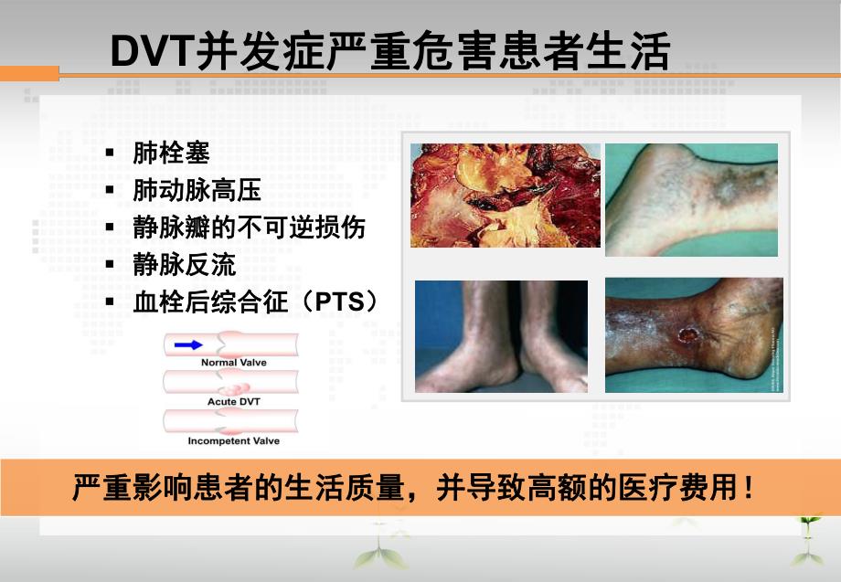 骨科大手术后VTE预防..ppt_第3页