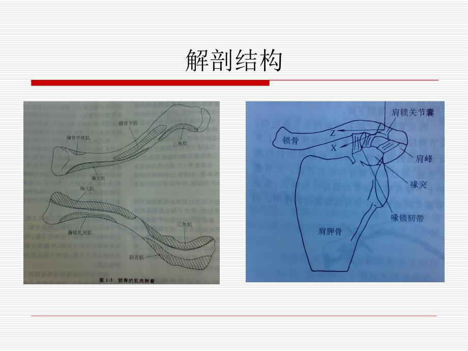 锁骨骨折.ppt_第2页