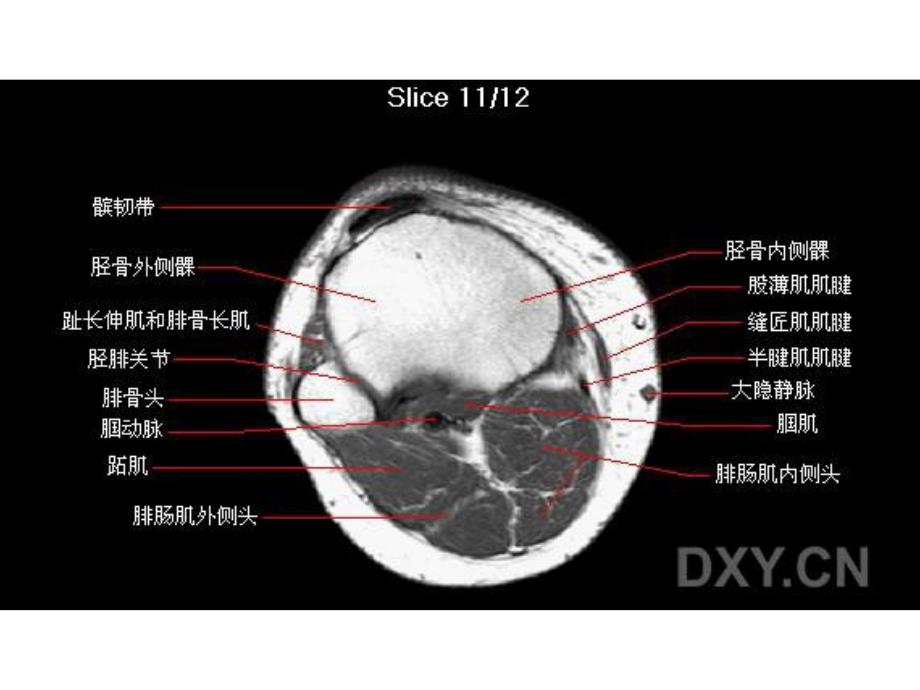 膝关节解剖.ppt_第2页