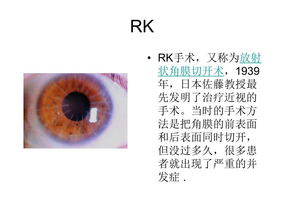 近视手术发展史.ppt_第3页