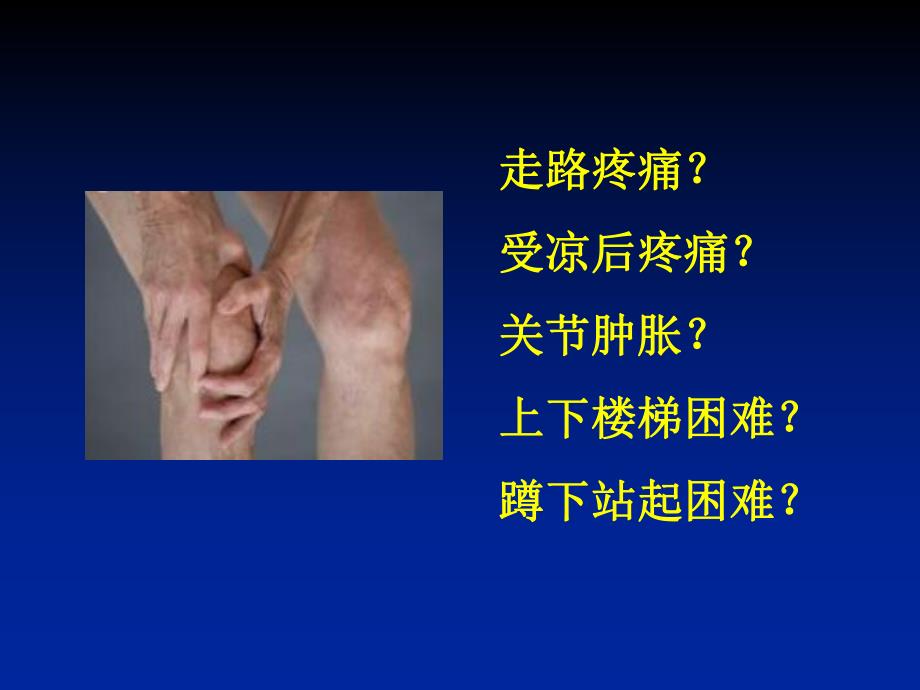 膝骨关节炎科普讲座上传.ppt.ppt_第3页