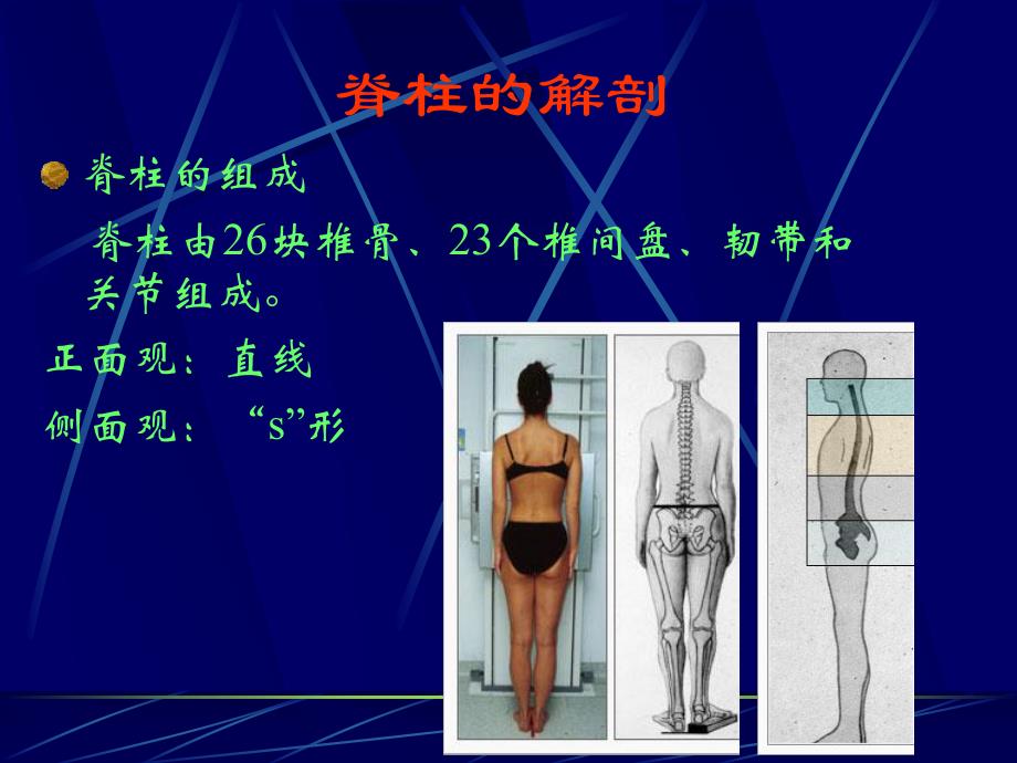 脊柱侧弯.ppt_第2页