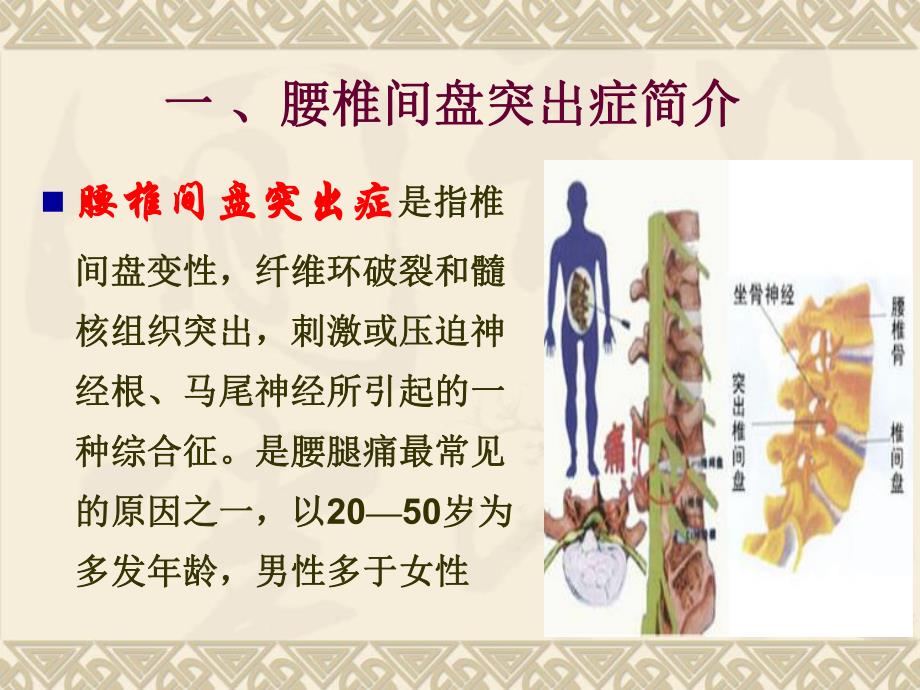 腰椎间盘突出症的健康教育精要.ppt_第3页