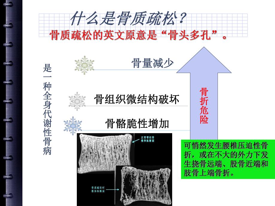 骨质疏松症的最新理论.ppt_第3页