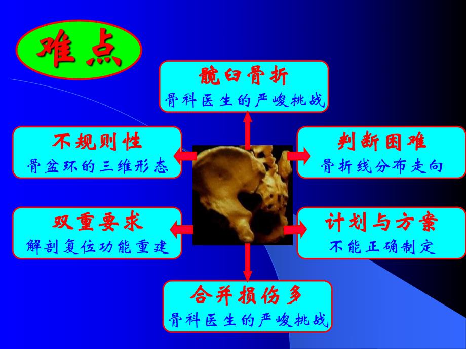 髋臼骨折的诊治难点分析.ppt_第3页