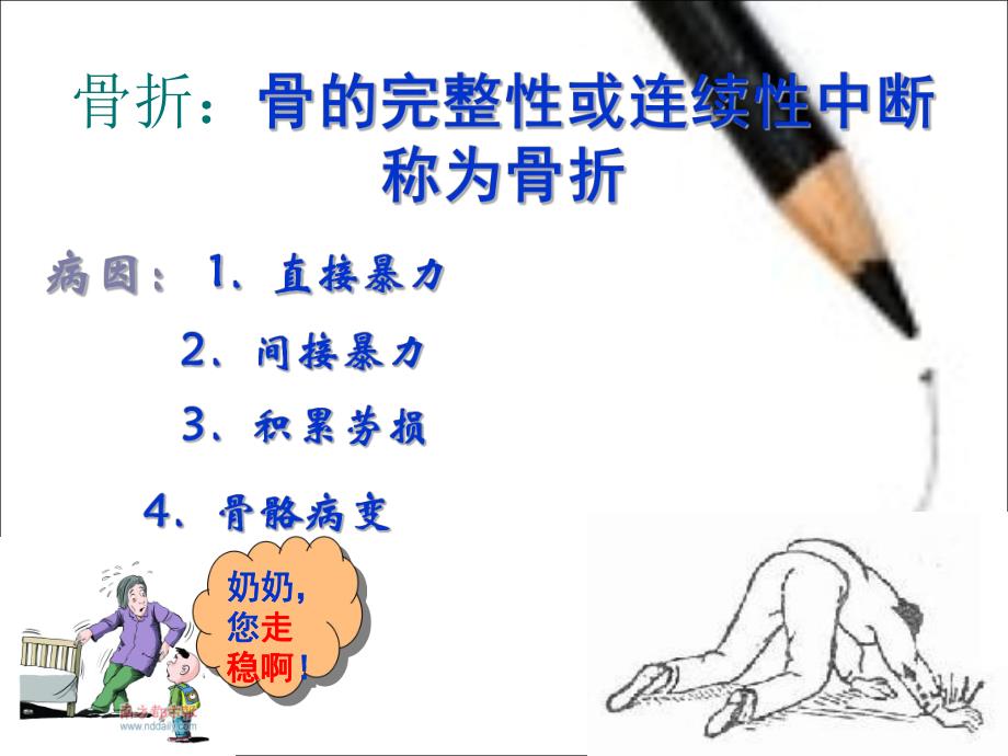 股骨粗隆间骨折的护理.ppt_第3页