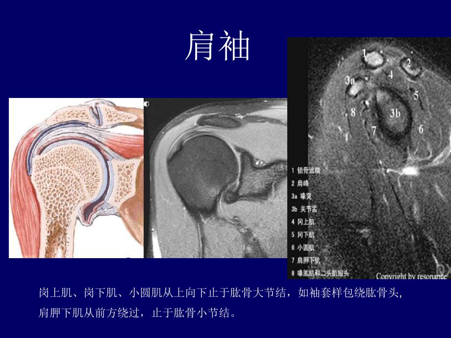肩关节应用解剖及腱鞘肌腱病的磁共振影像诊断.ppt_第3页