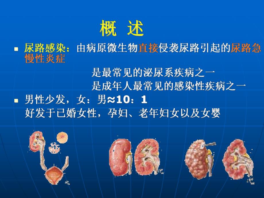 尿路感染病人的护理.ppt_第3页