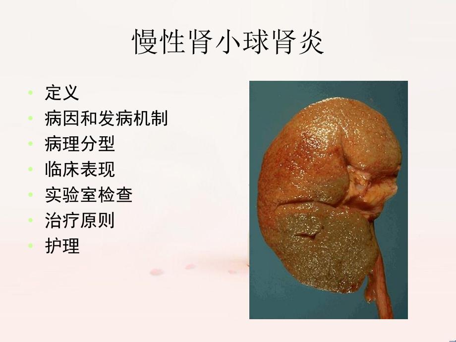 慢性肾小球肾炎的护理.ppt_第2页