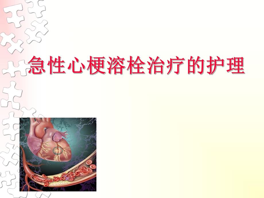 急性心梗溶栓治疗的护理.ppt_第1页