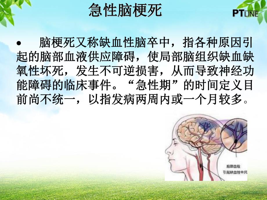 急性脑梗死患者溶栓治疗的观察与护理.ppt_第2页