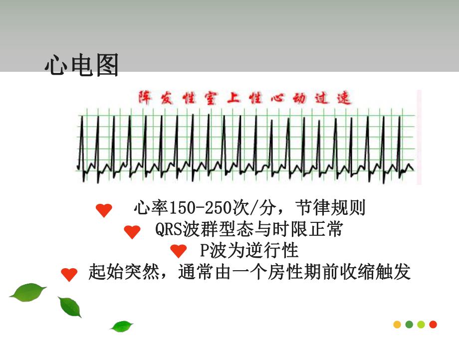 心内科护理查房—阵发性室上性心动过速.ppt_第3页