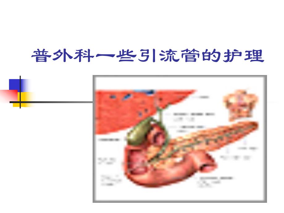 各种引流管的护理.ppt_第2页