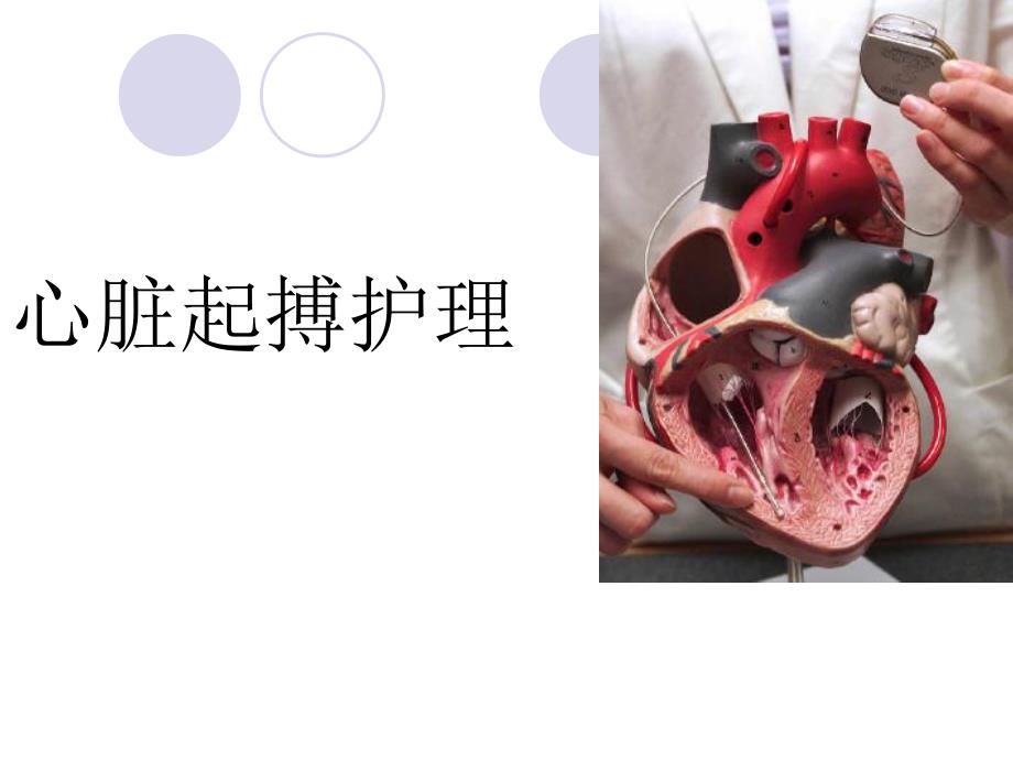 心脏起搏护理.ppt_第1页