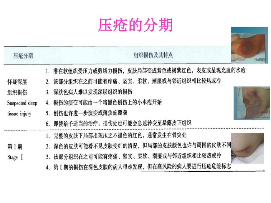 压疮伤口局部评估与护理记录指引.ppt_第3页