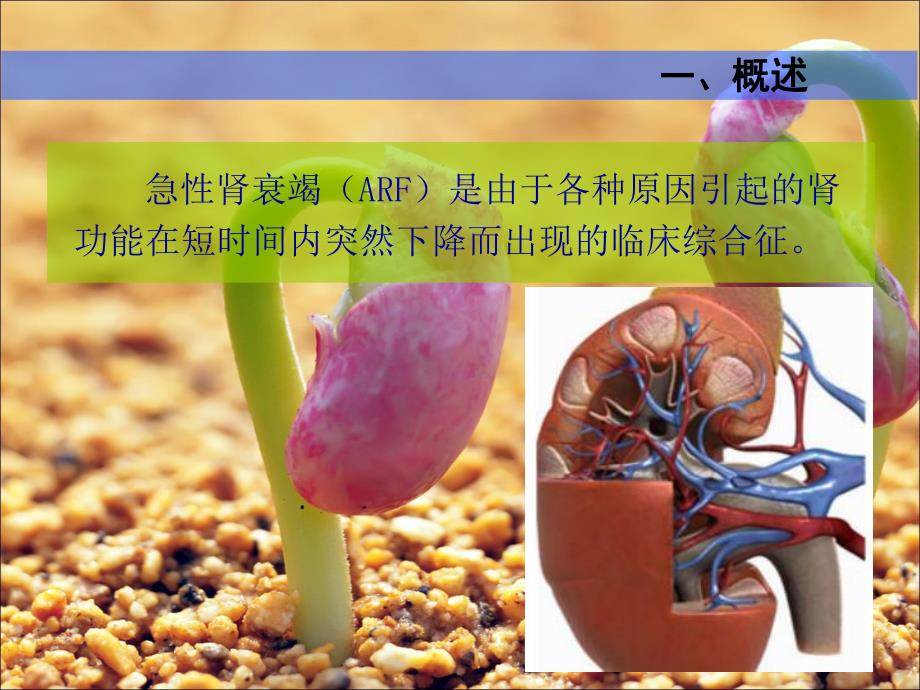 急性肾衰竭的护理.ppt.ppt_第3页