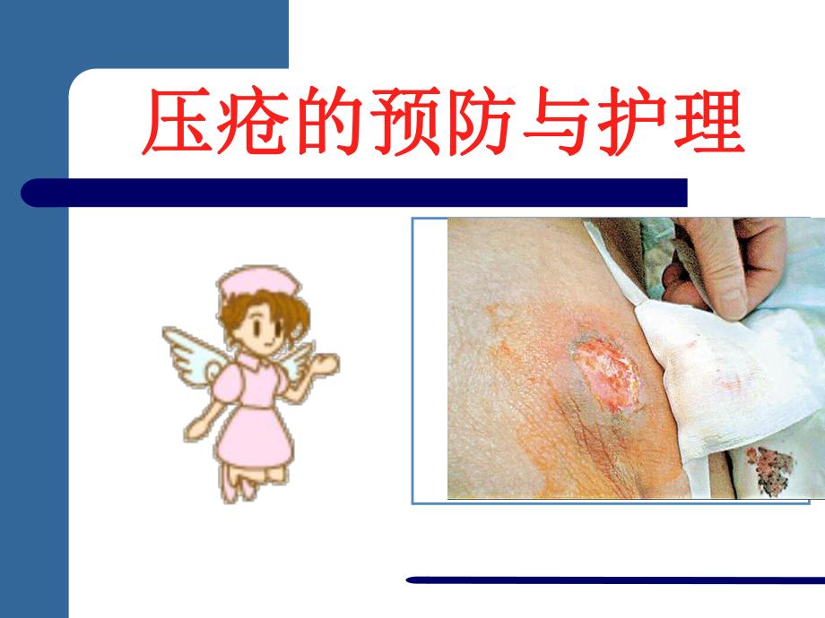 压疮的预防及护理.ppt_第1页