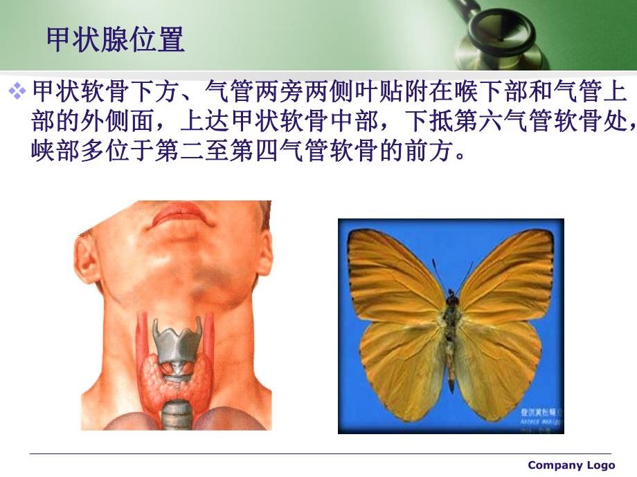 甲状腺的术后护理.ppt_第3页