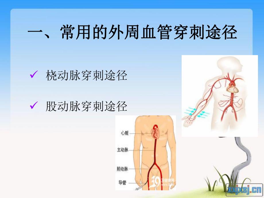 冠脉介入术后护理要点　.ppt_第2页