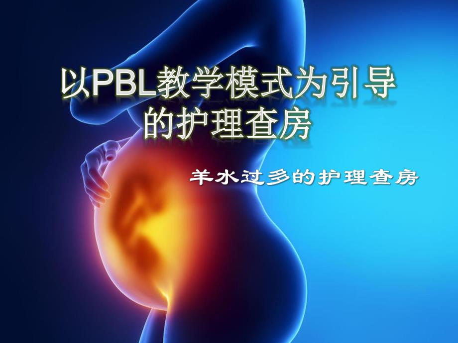 产五科羊水过多护理查房.ppt.ppt_第1页