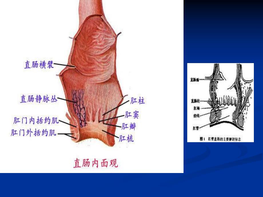 痔疮病人的护理.ppt.ppt_第3页