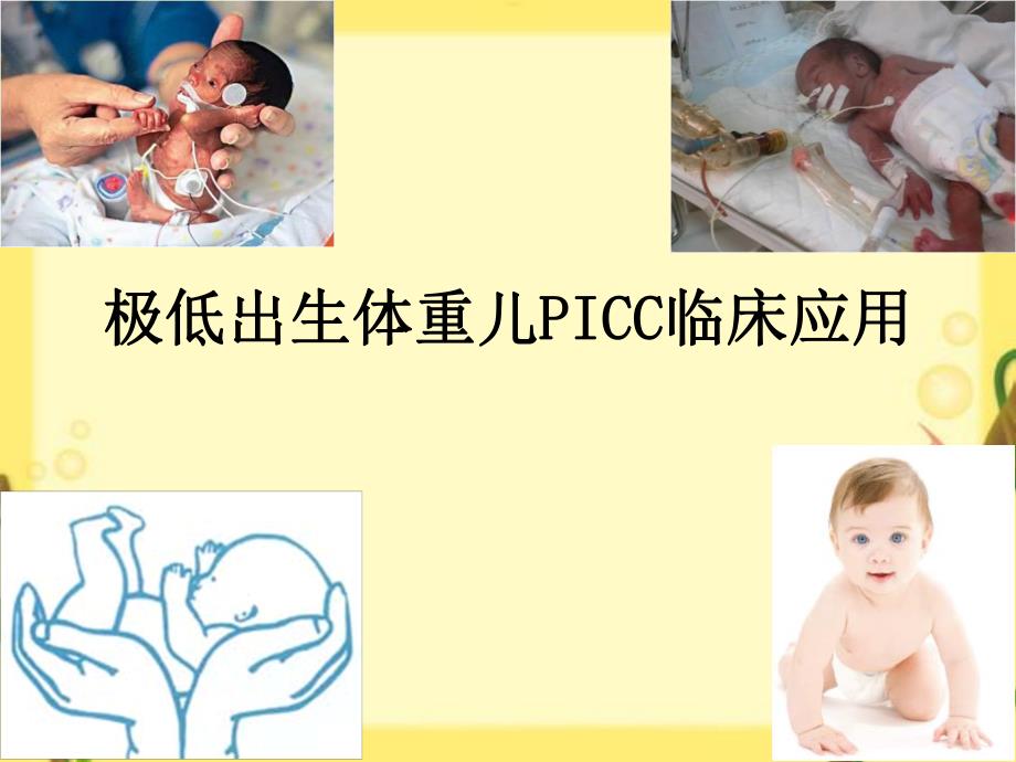 极低出生体重儿PICC临床应用.ppt_第1页