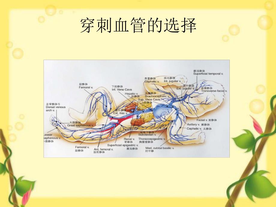 极低出生体重儿PICC临床应用.ppt_第3页