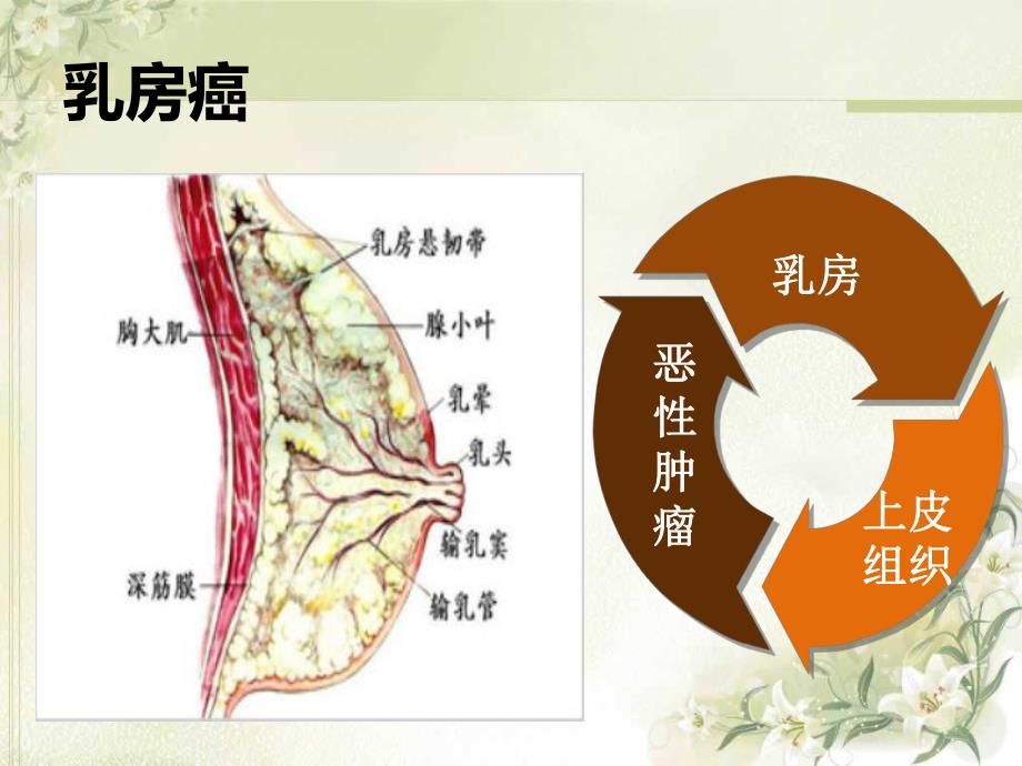 乳房癌的护理.ppt_第2页