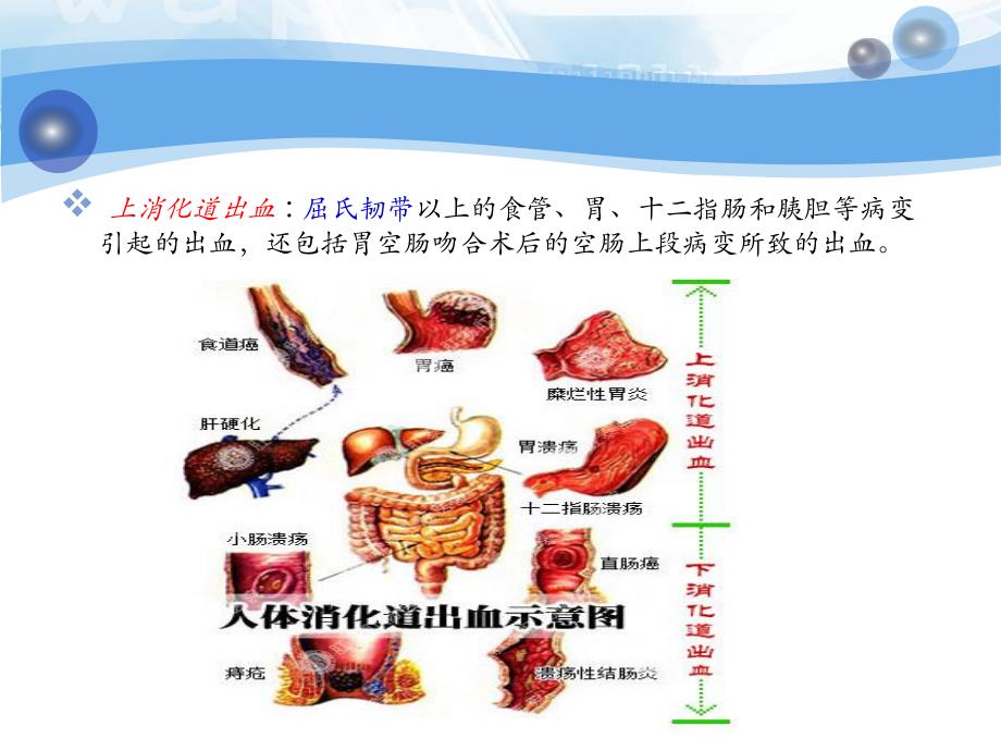 消化道出血病人的护理查房.ppt_第3页