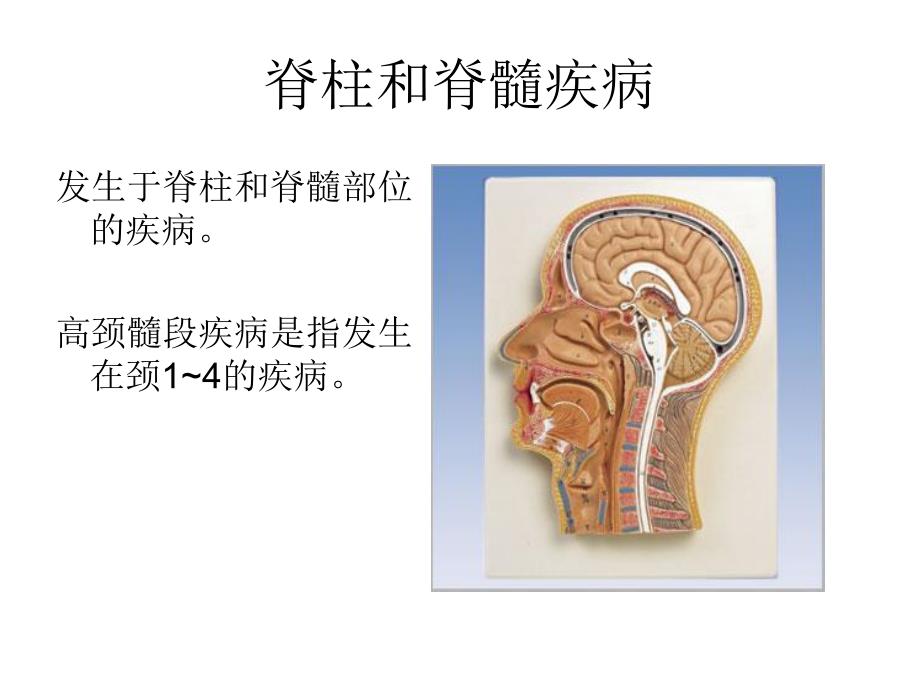 椎管疾病及术后护理.ppt_第2页