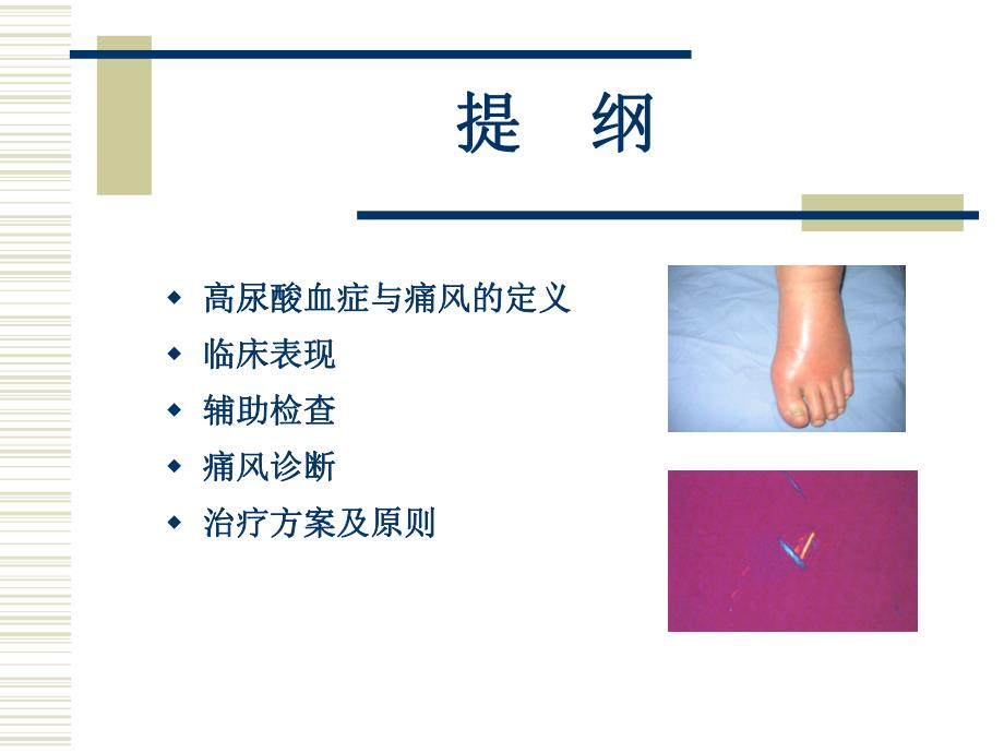 痛风教学查房.ppt_第2页