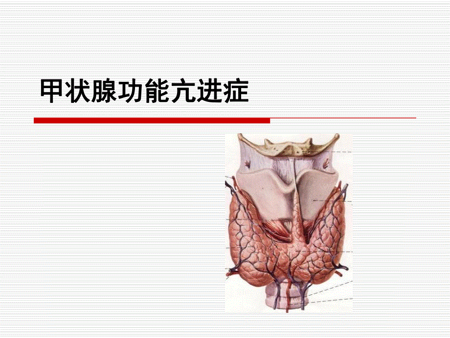 甲状腺功能亢进.ppt.ppt_第1页