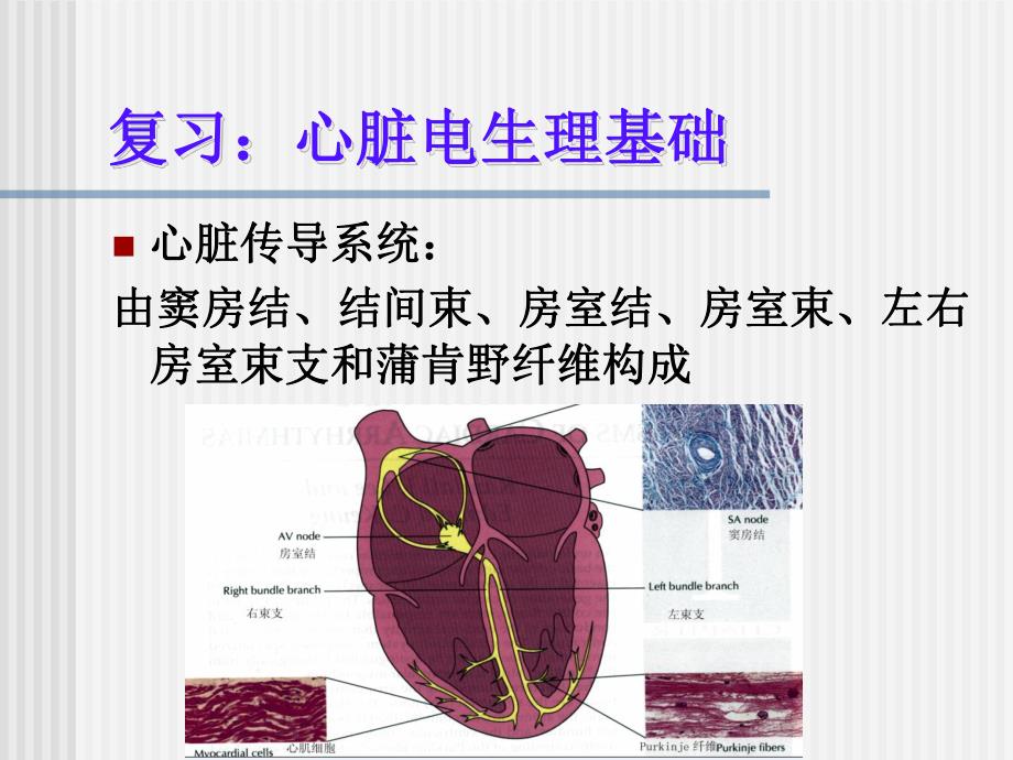 临时起搏器护理.ppt_第3页