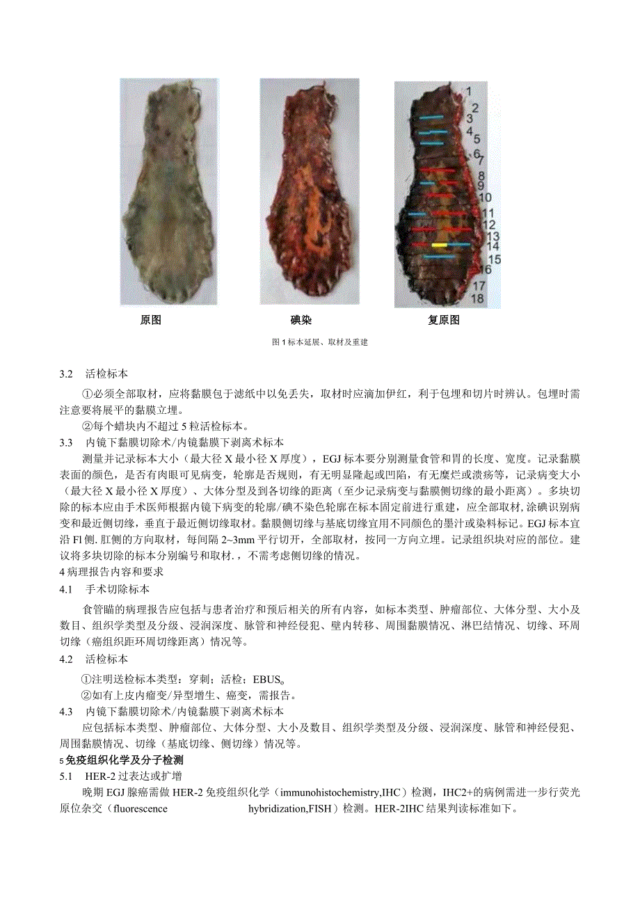 食管癌病理标本处理及报告规范.docx_第2页