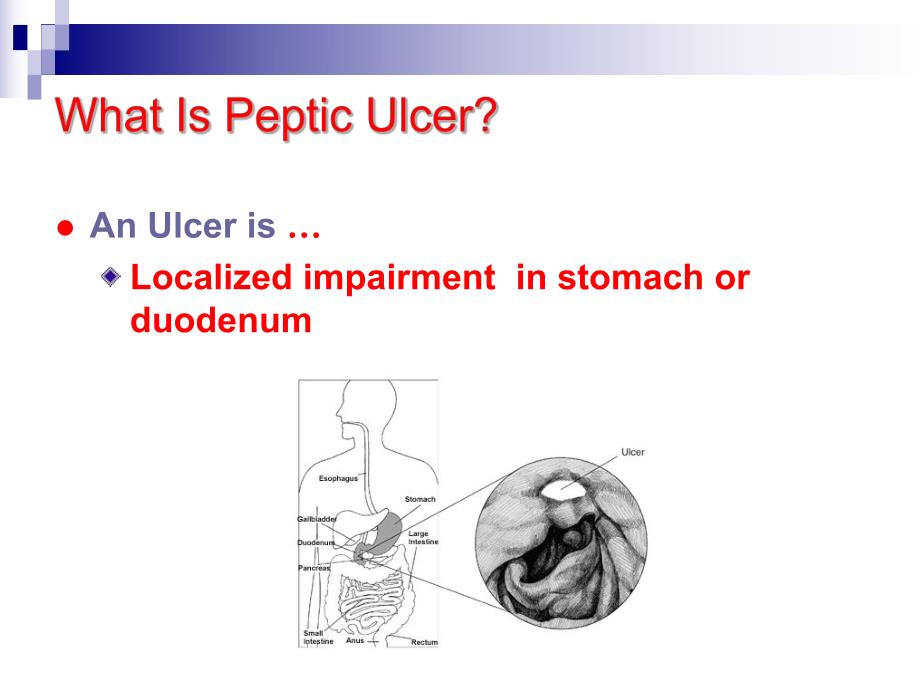 第32章作用于消化系统的药物.ppt_第3页