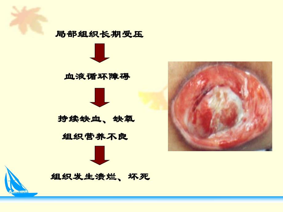 业务学习压疮预防及护理.ppt_第3页